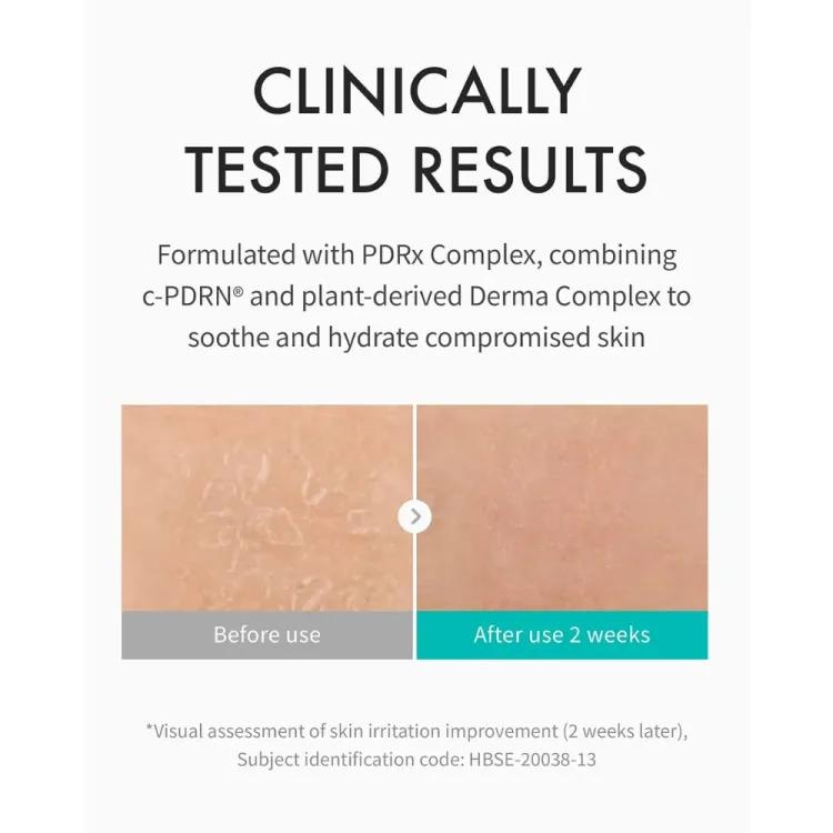 Rejuran Moisture Cream 60g