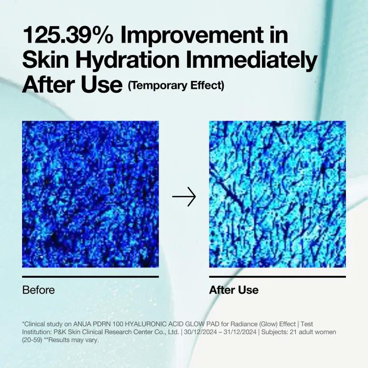 Anua Pdrn Hyaluronic Glow Pad (60ea), 180ml