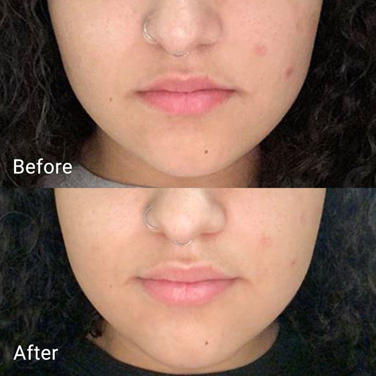 Aprilskin Calendula Peel Off Mask 100g
