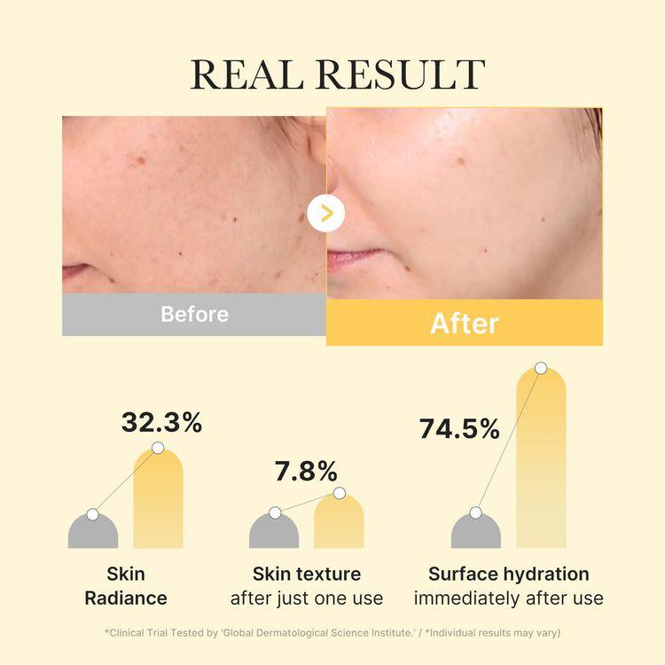 Medicube Kojic Acid Tumeric Brightening Gel Mask 28g