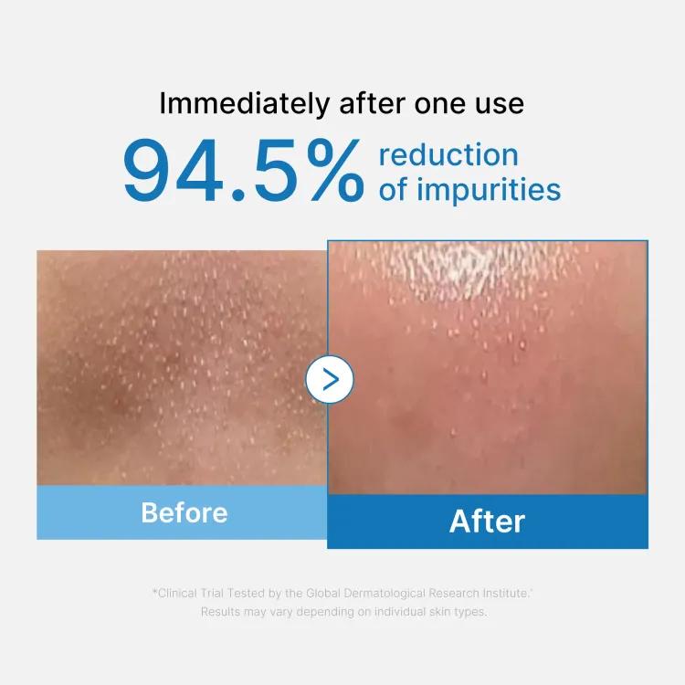 Medicube Zero Pore Blackhead Deep Cleansing Oil 205ml