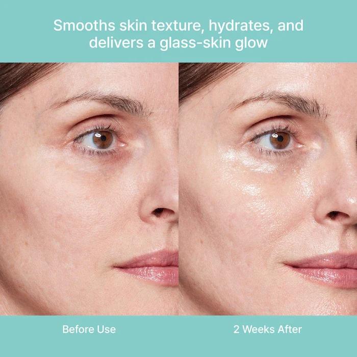 Rejuran Turnover Ampule 30 Ml